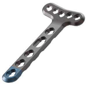 AUXEIN 2.4MM VARIXIS DISTAL RADIUS VOLAR PLATE,  EXTRA-ARTICULAR, (5 HEAD HOLES)  