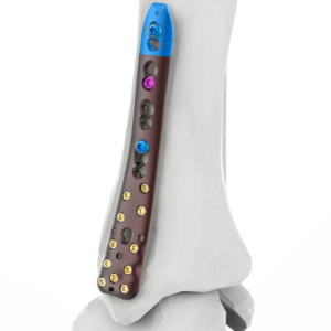 AUXEIN 2.7-3.5MM VARIXIS MEDIAL DISTAL TIBIA  PLATE  